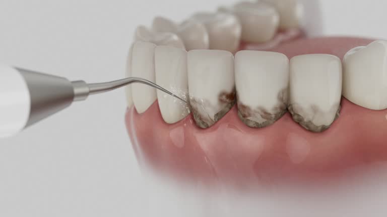Trusted Dental Implants service in Wathena, KS - Dentist Open Now